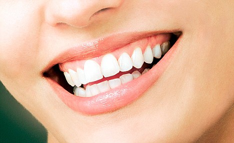 We have the best cosmetic veneers in Sydney.