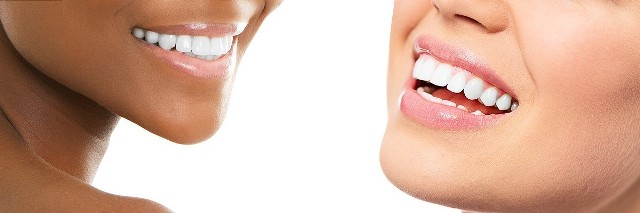 We have the best dental veneers here in Sydney.