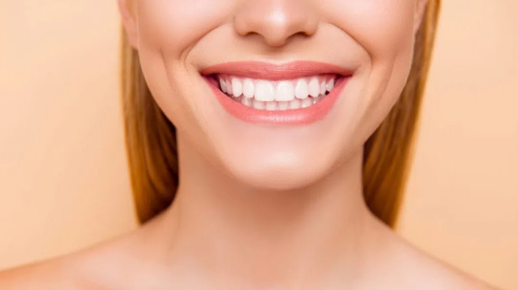 How Much Do Veneers Cost? Sydney Dental Veneers