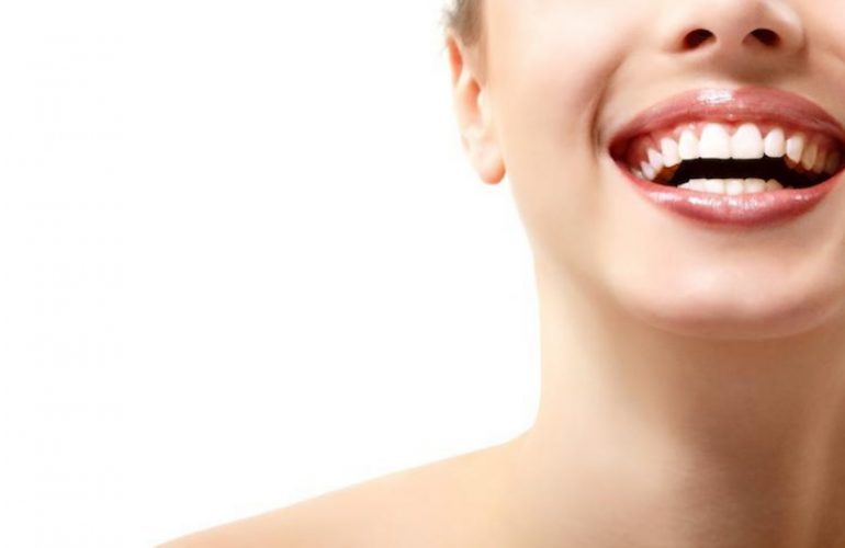 Dental Veneers Cost
