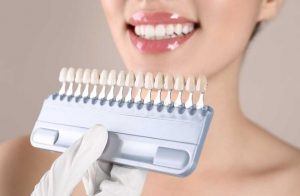 What are Porcelain Veneers