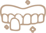 Illustration of porcelain veneers fitted to the upper front teeth