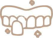 Illustration of porcelain veneers fitted to the upper front teeth