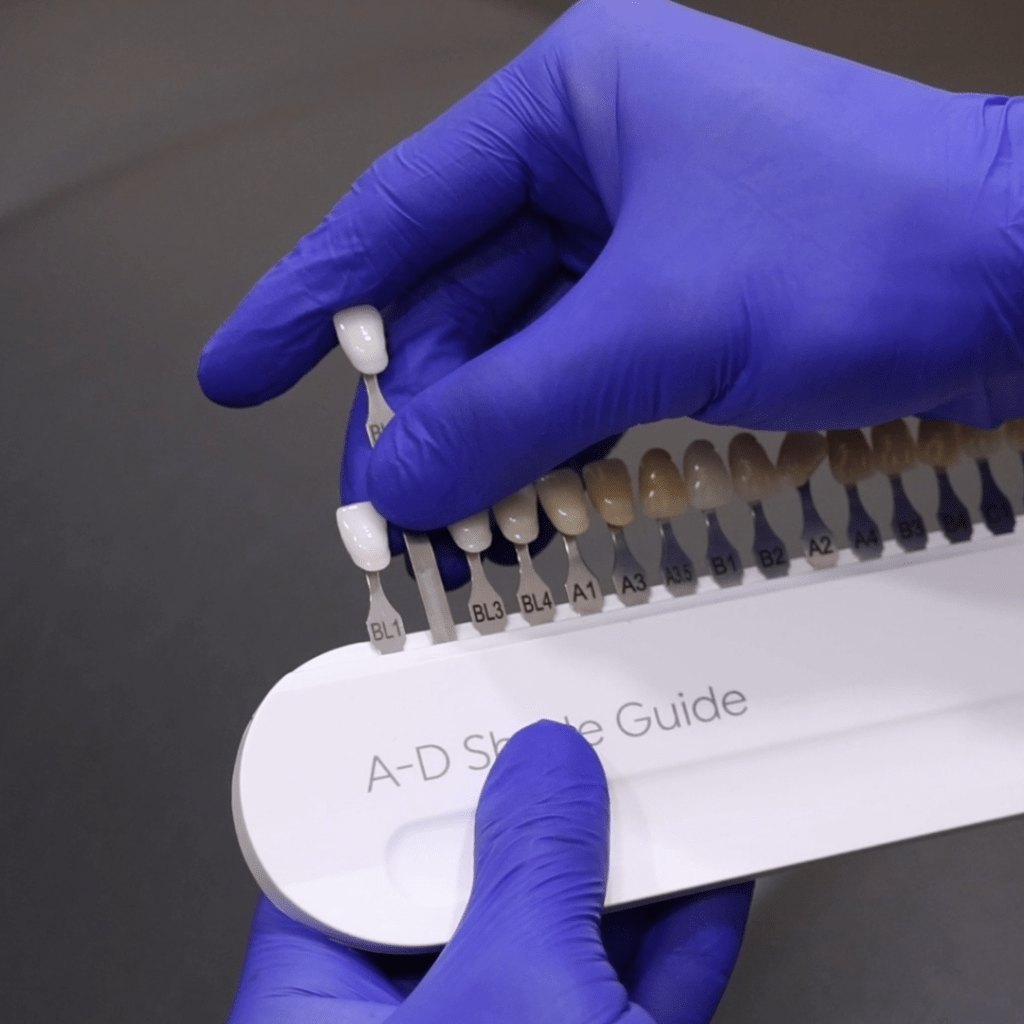 Composite Veneers in Sydney