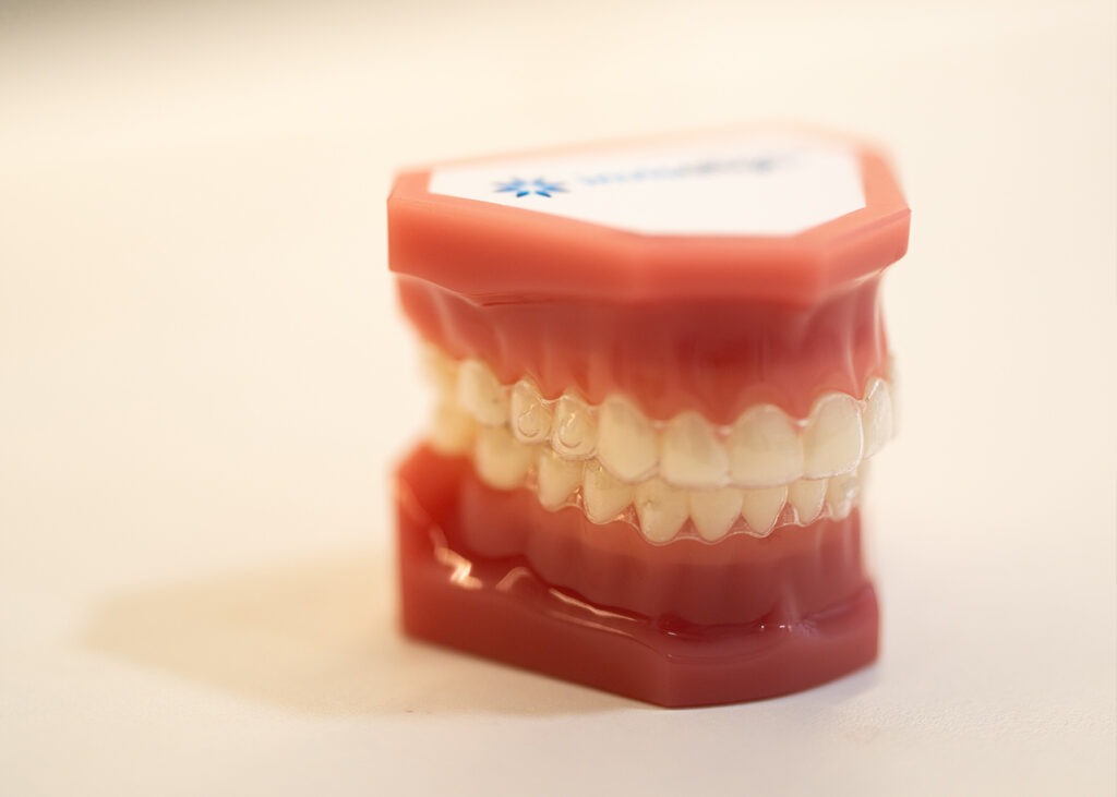 Invisalign clear aligners at Sydney Dental Veneers