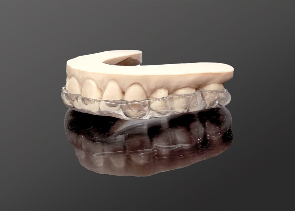 An educational model showing the discrete and virtually invisible look of clear aligners on teeth.