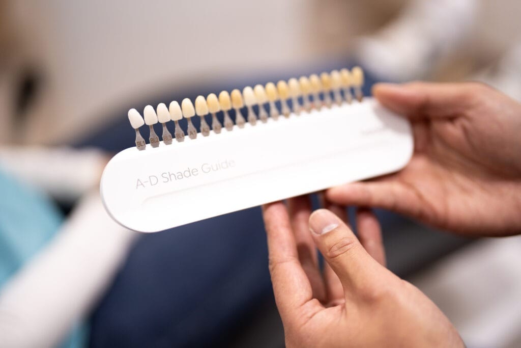 Teeth whitening treatment in Sydney Dental Veneers