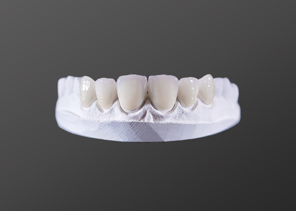 Dental Veneers Package