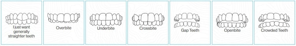 Issues Invisalign can fix