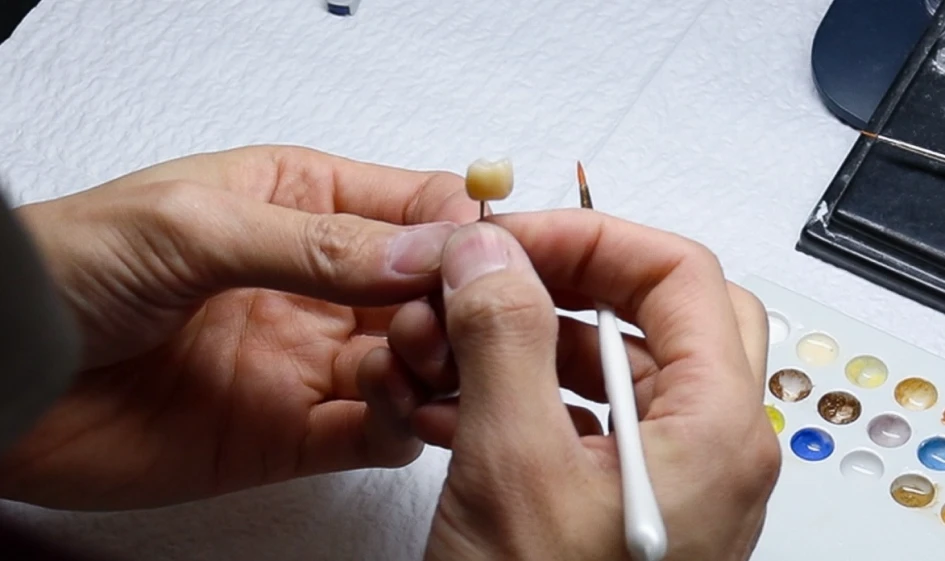 Ceramist shaping a porcelain veneer in our in-house laboratory